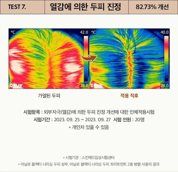 [뿌리볼륨] 아닐로 블랙티 너리싱 두피 트리트먼트 150ml 상세페이지 15